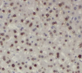 Phospho AKT1S1 (T246) Rabbit Polyclonal Antibody