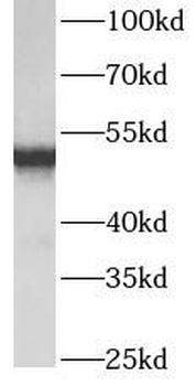ATP5F1B Antibody