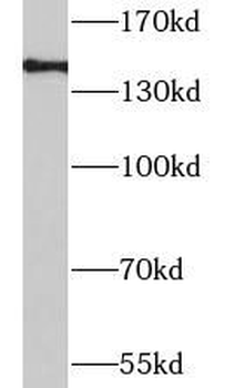 LRIG1 Rabbit Polyclonal Antibody