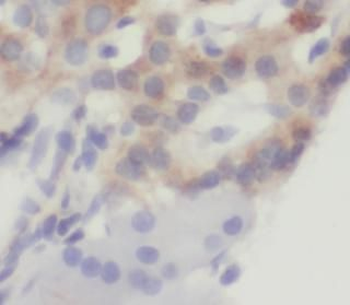 CCK Rabbit Polyclonal Antibody
