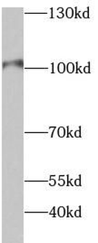 HK2 Rabbit Polyclonal Antibody