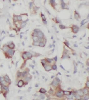 HK2 Rabbit Polyclonal Antibody