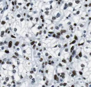 USP7 Antibody