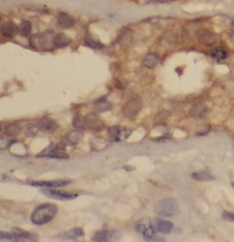 Phospho VEGF Receptor 2  (Y1175) Rabbit Polyclonal Antibody