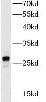 GSTM1 Rabbit Polyclonal Antibody