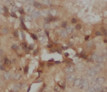 GSTM1 Rabbit Polyclonal Antibody