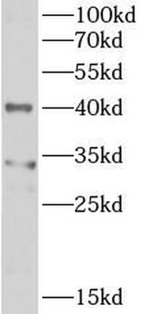 PPID Rabbit Polyclonal Antibody