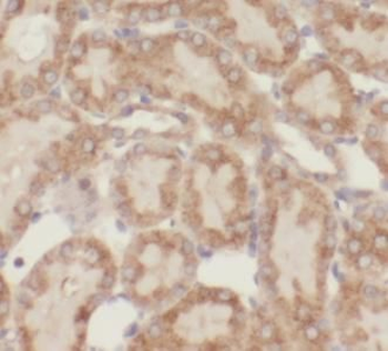 PPID Rabbit Polyclonal Antibody