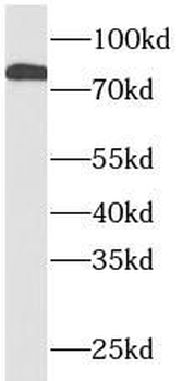 STAT1 Antibody