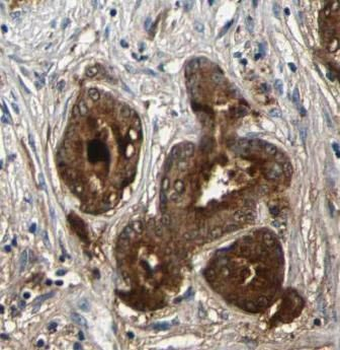 HSPA5 Antibody