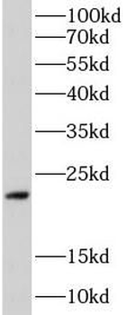 PLN Rabbit Polyclonal Antibody