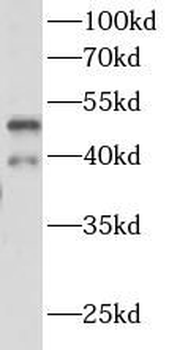 RHD Rabbit Polyclonal Antibody