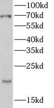 POLL Rabbit Polyclonal Antibody