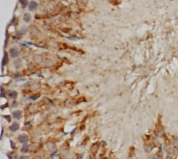 POLL Rabbit Polyclonal Antibody