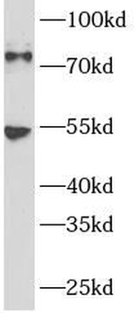 GAB1 Rabbit Polyclonal Antibody