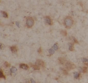 GAB1 Rabbit Polyclonal Antibody