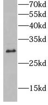 HLA DQB1 Rabbit Polyclonal Antibody