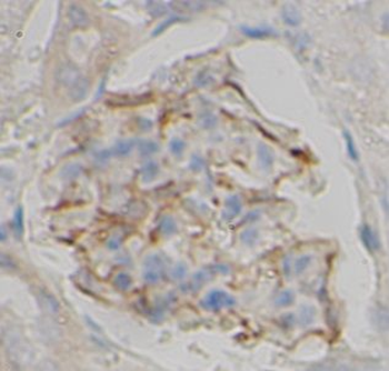 TK2 Antibody