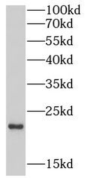 EREG Rabbit Polyclonal Antibody