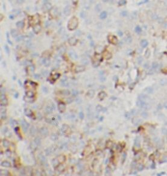 EREG Rabbit Polyclonal Antibody