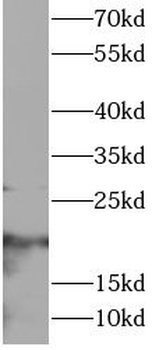 CD3E Rabbit Polyclonal Antibody