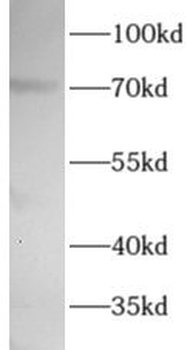 WEE1 Rabbit Polyclonal Antibody