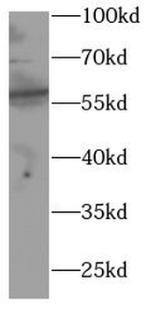 GK Antibody