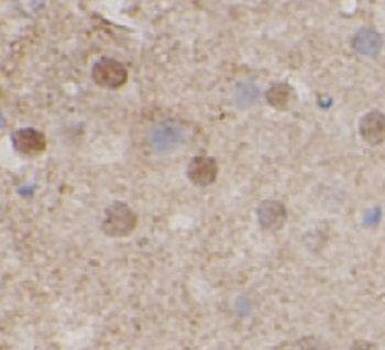 ARFGAP1 Rabbit Polyclonal Antibody