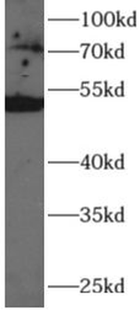 HAS3 Rabbit Polyclonal Antibody