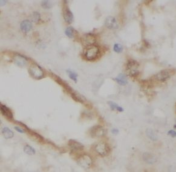 HAS3 Rabbit Polyclonal Antibody