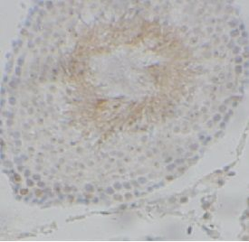 SKP1 Antibody