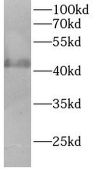 AURKA Rabbit Polyclonal Antibody