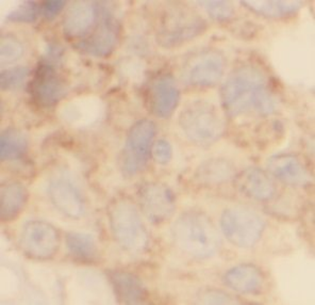 EML4 Rabbit Polyclonal Antibody