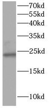 NPC2 Antibody