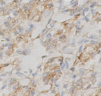 NPC2 Antibody