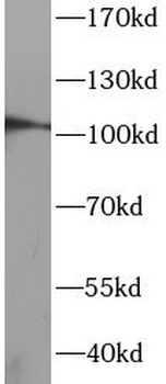 DDR1 Antibody