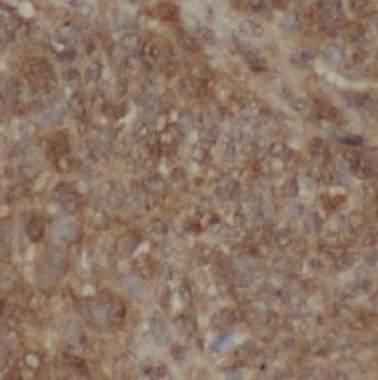 XDH Rabbit Polyclonal Antibody