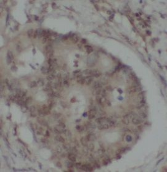 MTHFR Rabbit Polyclonal Antibody