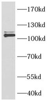 NCOR1 Rabbit Polyclonal Antibody