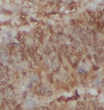 NCOR1 Rabbit Polyclonal Antibody