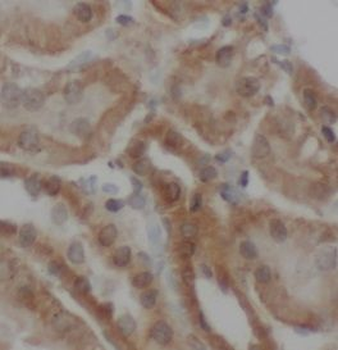 CDH2 Rabbit Polyclonal Antibody
