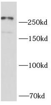 NCOR2 Antibody