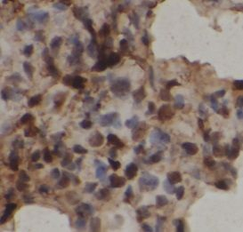 NCOR2 Antibody