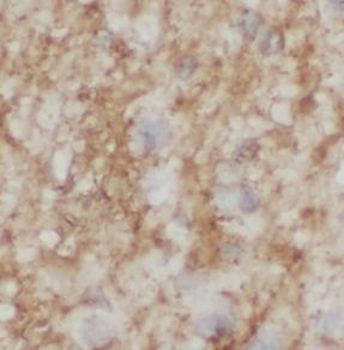 PLP1 Rabbit Polyclonal Antibody
