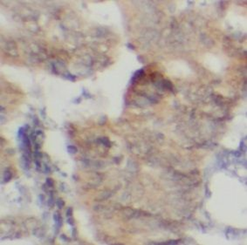 PLD2 Rabbit Polyclonal Antibody