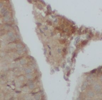 UTRN Rabbit Polyclonal Antibody