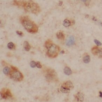 ADCYAP1 Rabbit Polyclonal Antibody