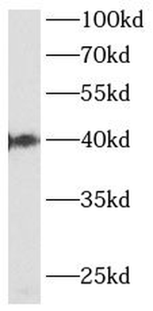 MTNR1B Rabbit Polyclonal Antibody