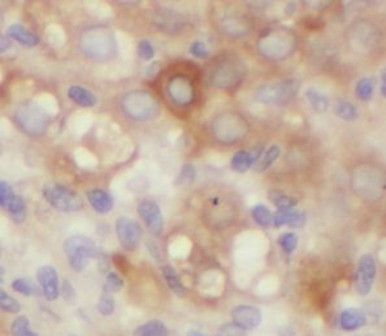 MTNR1B Rabbit Polyclonal Antibody