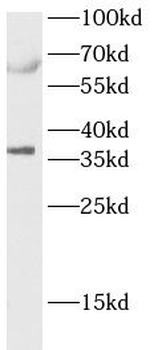 CASP7 Rabbit Polyclonal Antibody